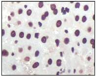 Anti-CDKN2A/p16INK4a antibody [2D9A12](AB54210)