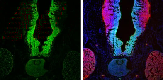 Anti-SOX2 antibody(AB137385)