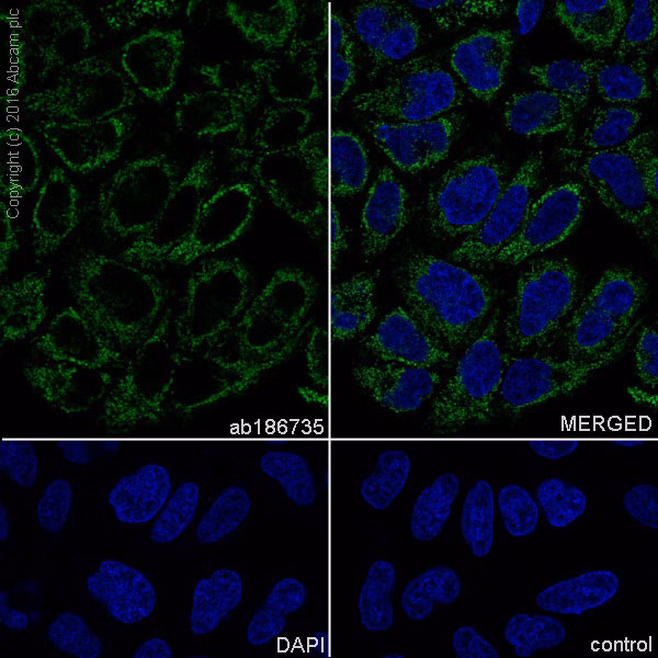 ab186735 staining TOMM20 in HeLa (human epithelial cell line from cervix adenocarcinoma) cells by ICC/IF (Immunocytochemistry/immunofluorescence).
