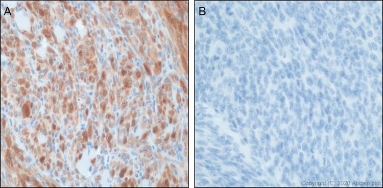 Anti-CDKN2A/p16INK4a antibody [PABLO33B](AB241543)