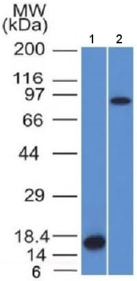 Anti-Factor XIIIa antibody [F13A1/1448](ab218392)