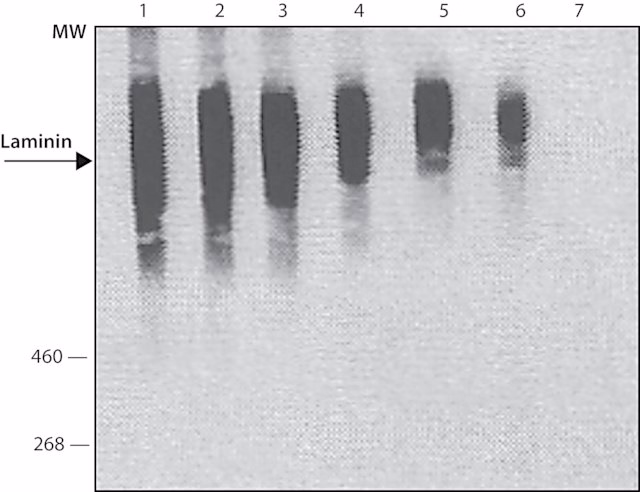 Laminin from murine sarcoma separated on SDS-PAGE, probed with rabbit anti-laminin (ab11575)