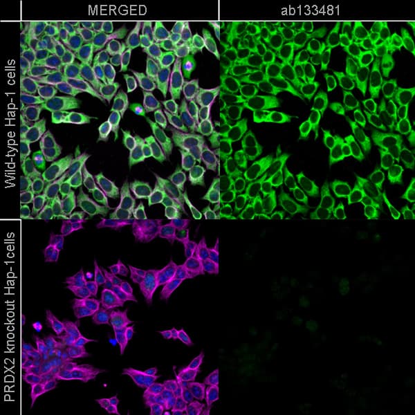 Peroxiredoxin 2 Prp Antibody Epr5155 Ab133481  Immunocytochemistry Immunofluorescence Img452334