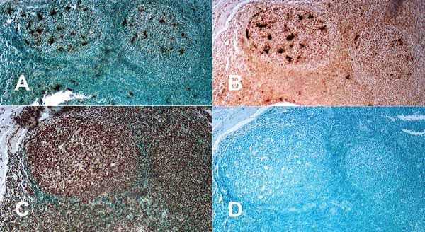 Human tonsil tissue section at 1000X magnification, paraffin-fixed, 10 μm. Section processed and counter-stained with methyl green, showing stained germinal centers.