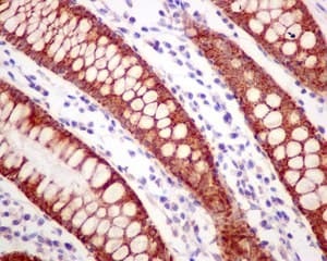 Ethe1 Antibody Epr11697 Bsa And Azide Free Ab249805  Immunohistochemistry Formalin Pfa Fixed Paraffin Embedded Sections Img26267