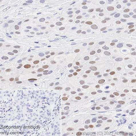 Immunohistochemistry (Formalin/PFA-fixed paraffin-embedded sections) - Anti-PRAME antibody [EPR20330] (ab219650)