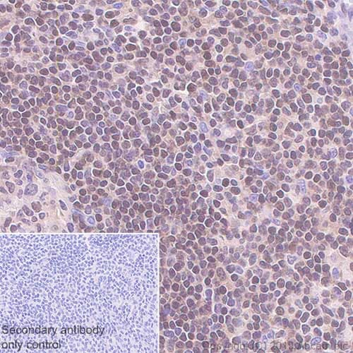 Anti-FOXO1A antibody [EPR12020](AB179450)