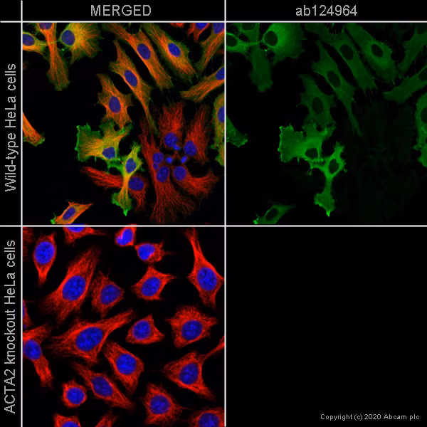 AB124964 staining alpha smooth muscle Actin in wild-type HeLa cells shown in the top panel and ACTA2 knockout HeLa cells displayed in the bottom panel