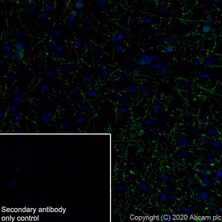 Image of Myelin Basic Protein in human cerebrum
