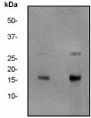 Western blot analysis of gamma H2A.X phosphorylation in Jurkat cells treated with etoposide.