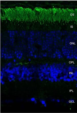 Rhodopsin Antibody Rho 4d2 Ab98887  Immunohistochemistry Frozen Sections Img66204