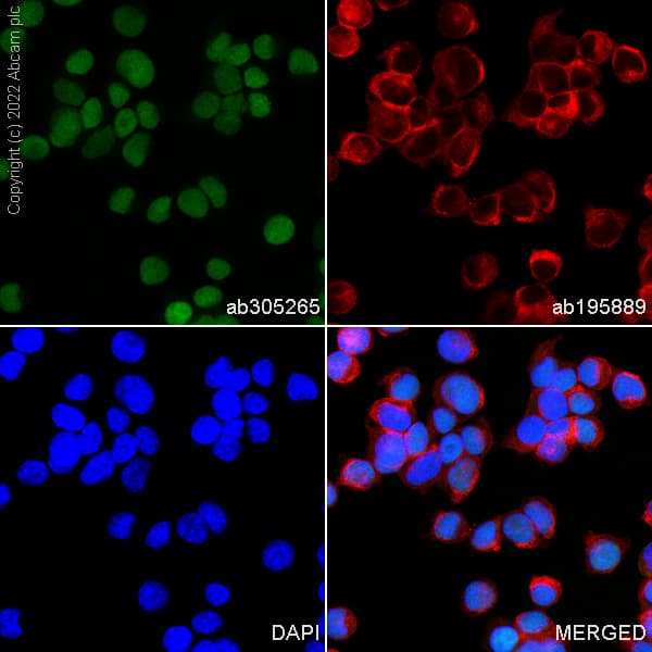 Alexa Fluor® 488 Anti-p53 antibody [EPR20416-120](AB305265)