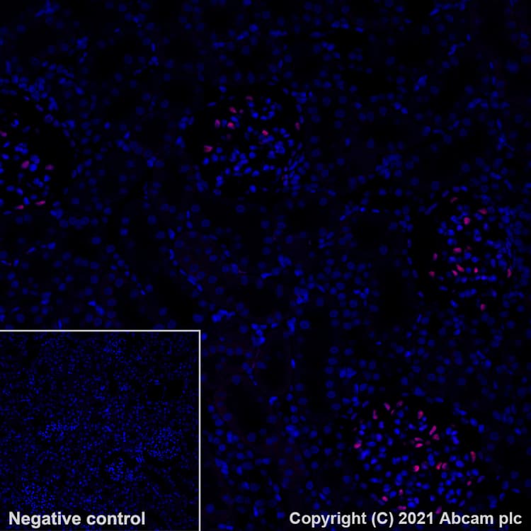 Alexa Fluor® 647 Anti-Wilms Tumor Protein antibody [EPR23963-116](AB283325)