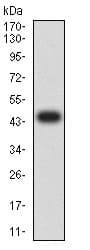 Rank Antibody 8h8b2 Ab233817  Western Blot Img153487