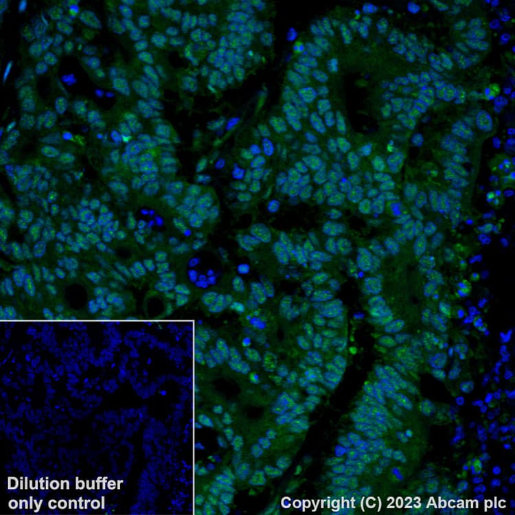 Alexa Fluor 488 Brd4 Antibody Epr51502 Ab197606  Immunohistochemistry Formalin Pfa Fixed Paraffin Embedded Sections Img448808
