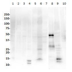 Western blot of PAX1-9 transfected HEK-293 cell lysates probed with anti-PAX8 antibody.