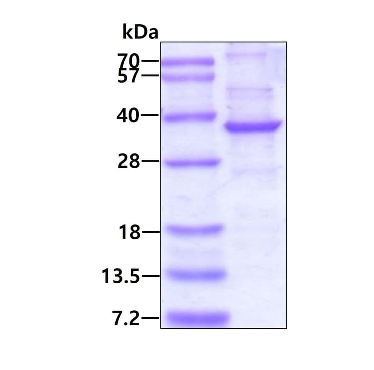 Recombinant Human NEURL2 protein (denatured)(AB171589)