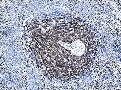 Anti-CD3 epsilon antibody [SP7] - BSA and Azide free(AB205228)