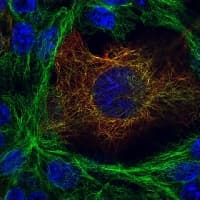 Alpha Tubulin Antibody B 5 1 2 Microtubule Marker Ab11304  Immunocytochemistry Img95661