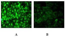 Estrogen Receptor Alpha Phospho S118 Antibody E91 Ab32396  Immunocytochemistry Immunofluorescence Img71217