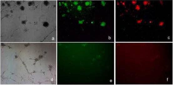 Immunofluorescence microscopy of mouse mesenchymal stem cells (mMSCs) stained with antibodies against FoxP3 (green) and CCR8 (red). Treatment with anti-CCL1 inhibits expression of CCR8 and FoxP3. Image from Haque et al., 2019. Used under CC BY 4.0 license.