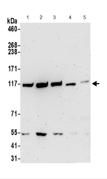 Anti-GART antibody(AB187716)