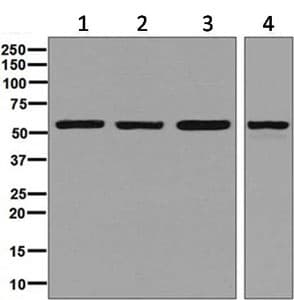 Fkbp52 Antibody Epr6618 Bsa And Azide Free Ab240535  Western Blot Img32836