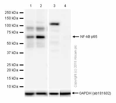 Anti-NF-kB p65 antibody [E379](AB32536)