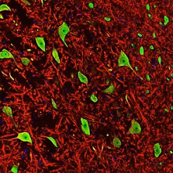 Immunofluorescent analysis of rat brain stem co-stained with Fox3/NeuN (green), MAP2 (red), and DAPI (blue).