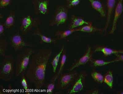 Anti-SDHA antibody [2E3GC12FB2AE2](AB14715)
