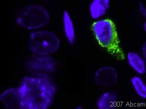 Anti-Mast Cell Tryptase antibody [AA1](ab2378)