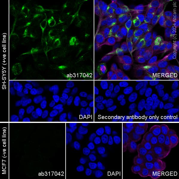 Anti-NEFH antibody [EPR20020] - Chicken IgY (Chimeric) - BSA and Azide free(AB317043)