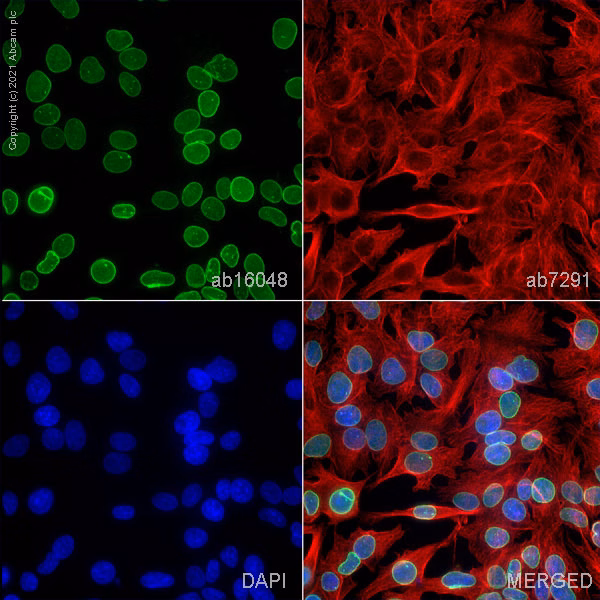 Immunofluorescence staining of Lamin B1 in HepG2 cells, showing nuclear localization in blue, microtubules in red, and Lamin B1 in green