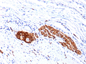 Anti-NCAM1 antibody [123C3.D5 + 123A8](AB200698)