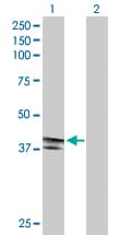 Eda2r Xedar Antibody Ab167224  Western Blot Img57649