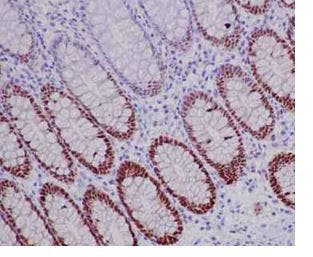 Immunohistochemistry analysis of paraffin-embedded human colon tissue labeling SOX9 with ab185966 at 1/1000 dilution.