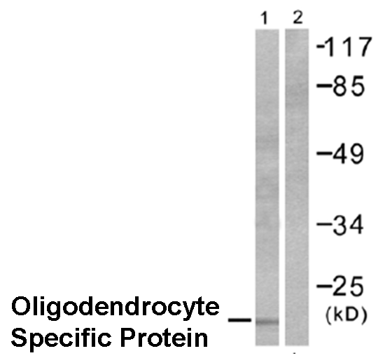 Anti-Oligodendrocyte Specific Protein antibody - Oligodendrocyte Marker(AB53041)