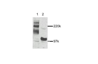 Anti-NFkB Inducing Kinase NIK antibody(AB7204)
