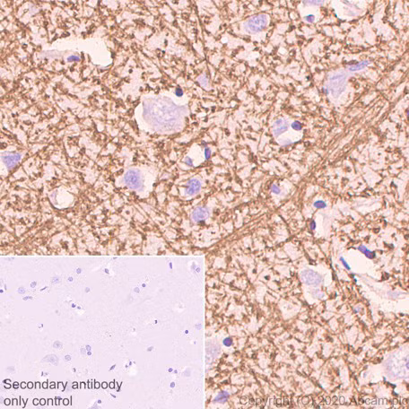 Immunohistochemical staining of human cerebrum showing myelin basic protein (MBP) expression.