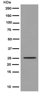 Claudin 17 Antibody Epr15483 Ab186744  Western Blot Img143680