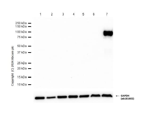 Anti-MMP9 antibody [RM1020](AB283575)