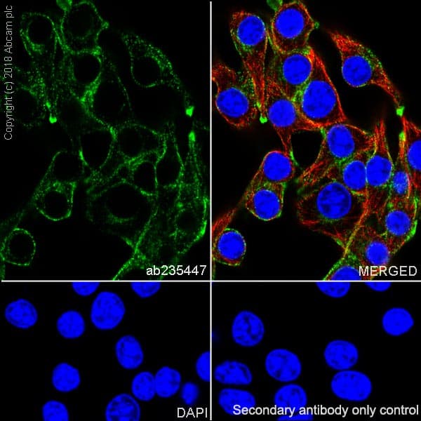 Anti-TRP1 antibody [EPR21960](AB235447)