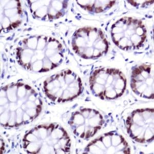 Anti-SATB2 antibody [SP281] - C-terminal(AB227686)