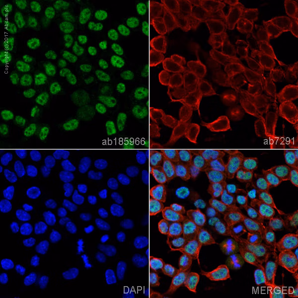 ab185966 staining Sox9 in F9 (mouse embryonic testicular cancer cell line) cells.