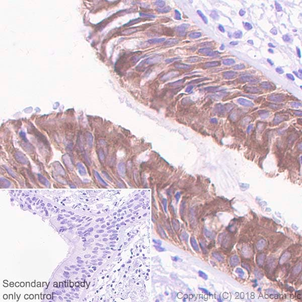 15 Lipoxygenase 1 Antibody Epr22136 Bsa And Azide Free Ab243555  Immunohistochemistry Formalin Pfa Fixed Paraffin Embedded Sections Img102933