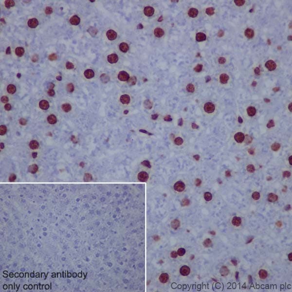 Anti-Histone H3 (tri methyl K9) antibody [EPR16601] - ChIP Grade(AB176916)