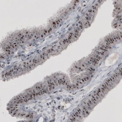 Anti-NIFK antibody [CL2240] - Nucleolar Marker(AB211871)