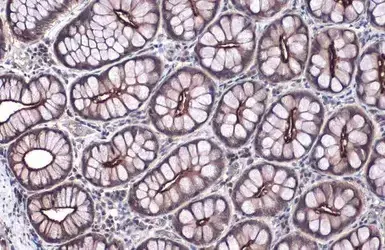 Anti-Villin antibody(AB97512)