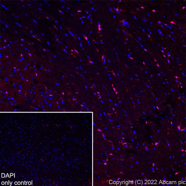 Alexa Fluor® 594 Anti-S100 beta antibody [EP1576Y] - Astrocyte Marker(AB307851)