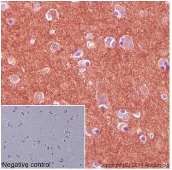 Pan Trk Antibody Epr17341 Ab181560 Immunohistochemistry Formalin Pfa Fixed Paraffin Embedded Sections Img64221
